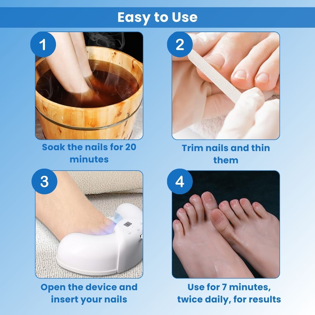 NailCure Pro™ - Laser Nail Treatment Device