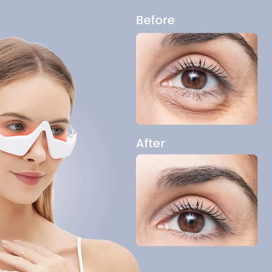 LumeEye™ - Dark Circle Eliminator Pro