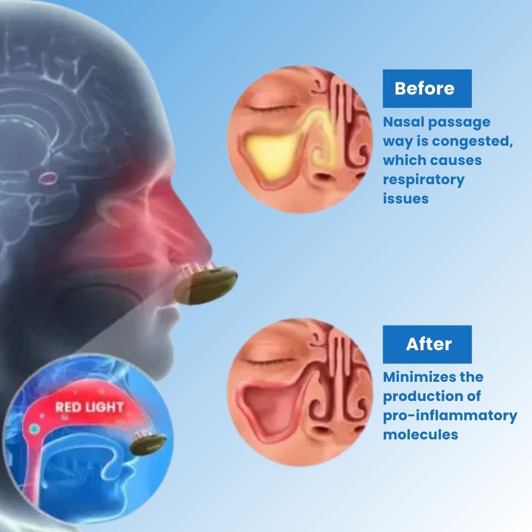 ComfyNas™ - Comfortable Nasal Solution