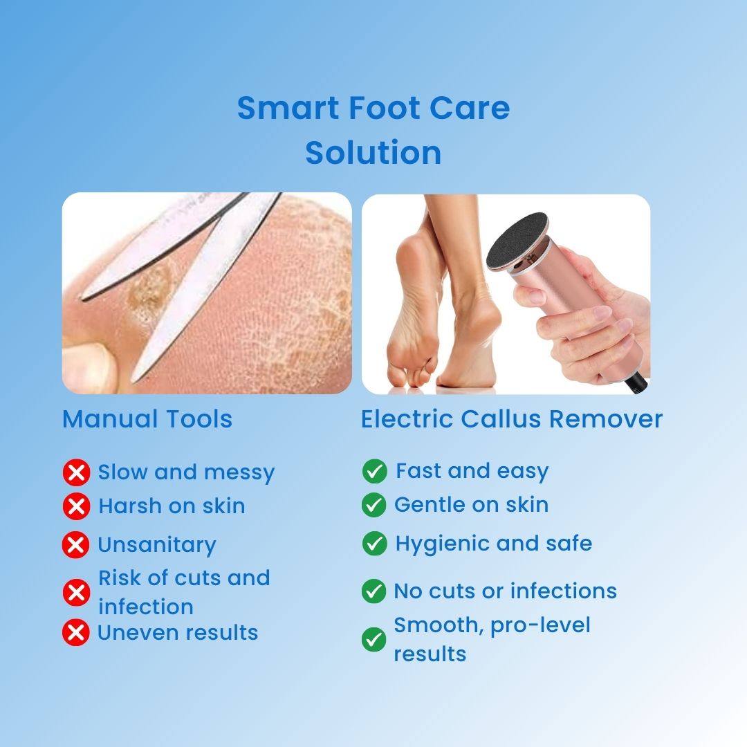 CallusCut™ - Electric Foot Callus Remover