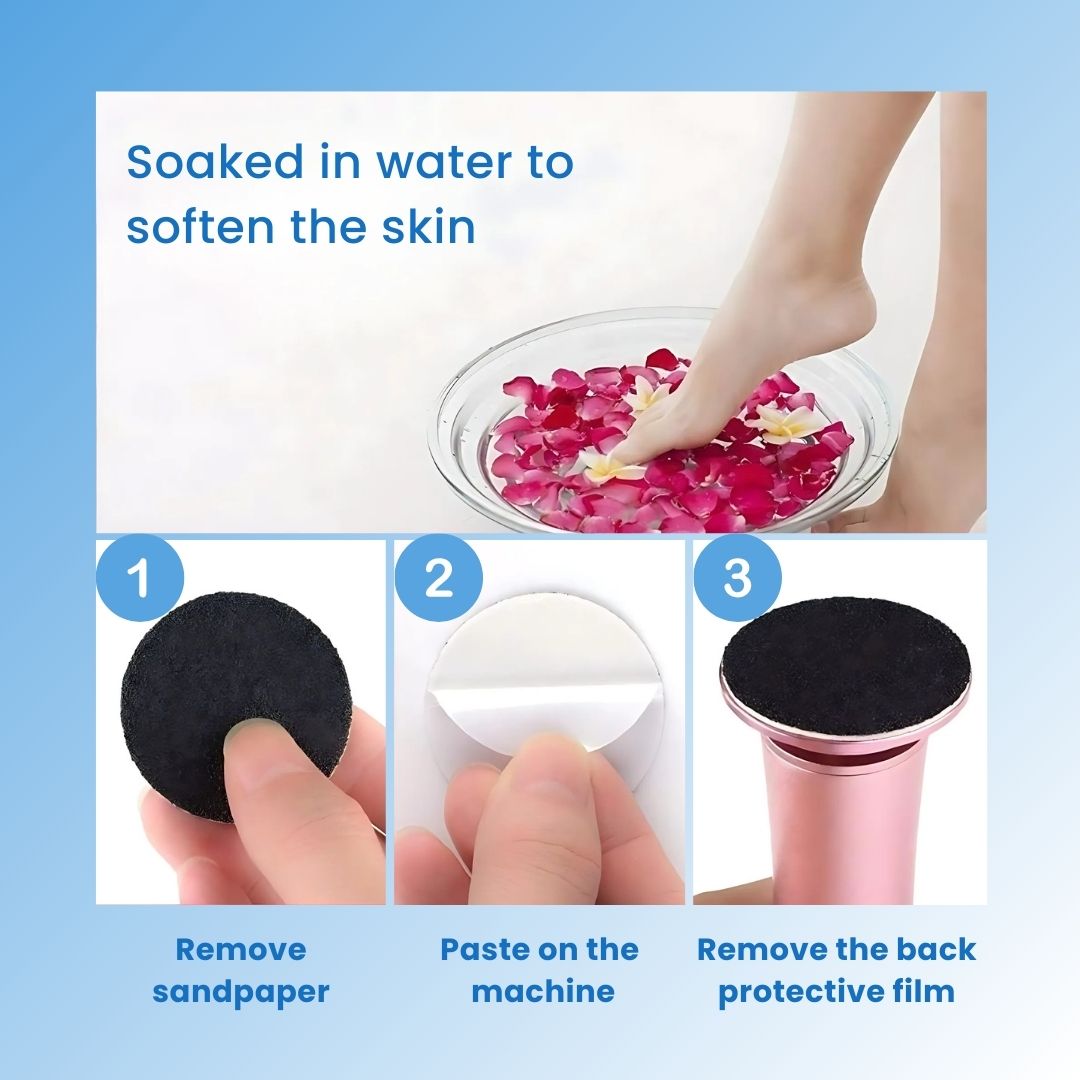 CallusCut™ - Electric Foot Callus Remover