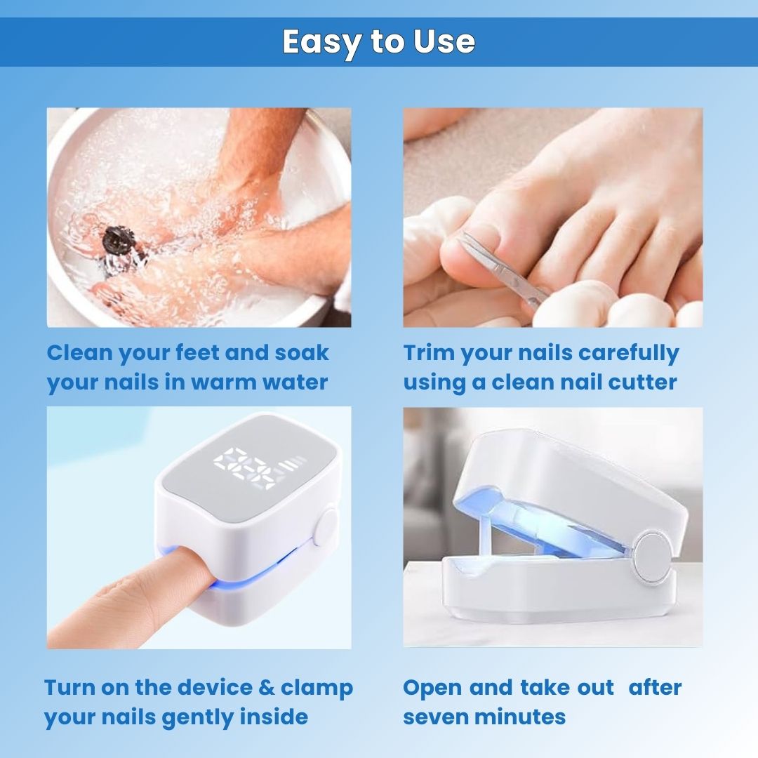 FungeeFree™ - Nail Fungus Laser