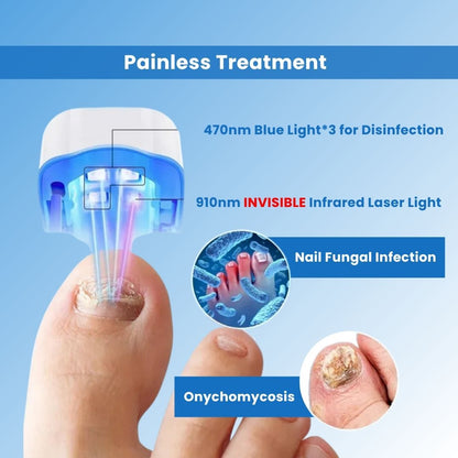 FungeeFree™ - Nail Fungus Laser