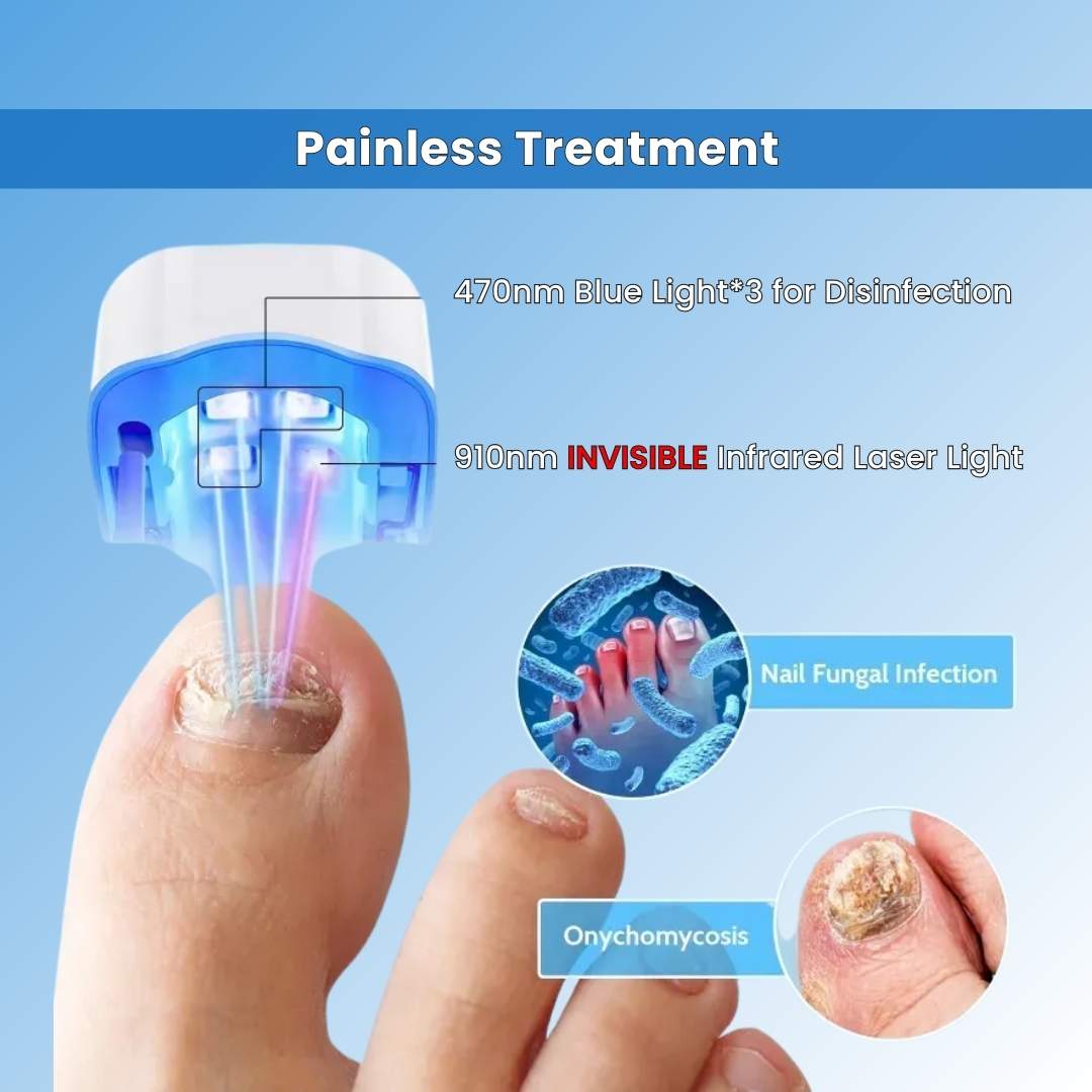 FungeeFree™ - Nail Fungus Laser