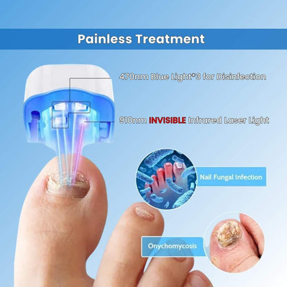 FungeeFree™ - Nail Fungus Laser