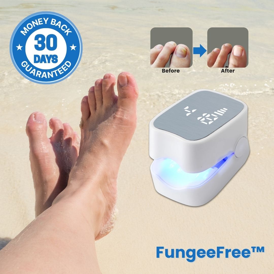 FungeeFree™ - Nail Fungus Laser